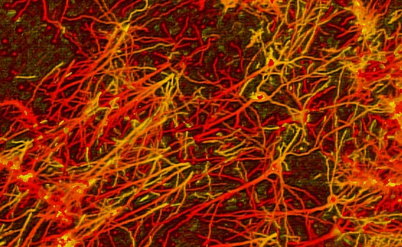 some neuron types